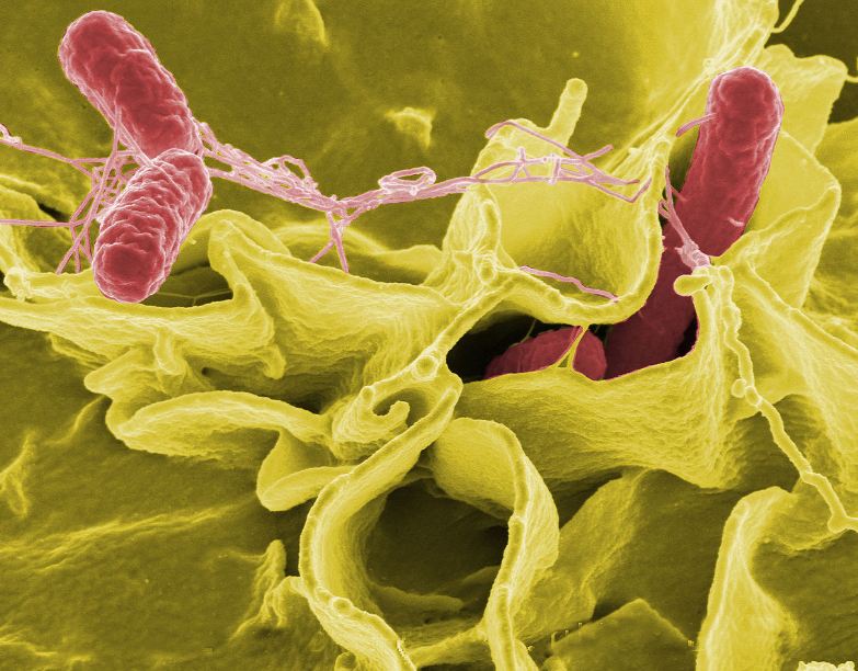 Salmonella merupakan jenis dari bakteri enterobakteria gram-negatif yang bentuknya seperti tongkat. Salmonella sendiri dapat menyebabkan gangguan seperti tifoid (tipus), paratifod, dan penyakit foodborne. Spesies-spesies Salmonella sendiri dapat bergerak bebas dan menghasilkan hidrogen sulfida.